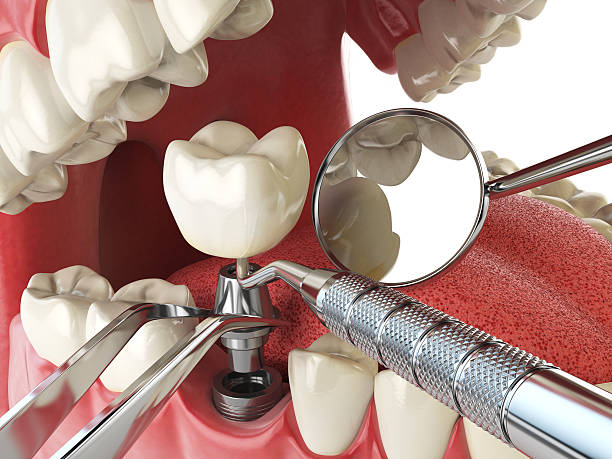 Reliable MI Emergency Dentist Solutions